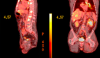 Diagnostic Algorithms in Metastatic Patients