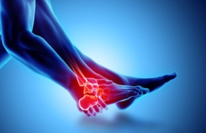 What is Diabetic Foot?