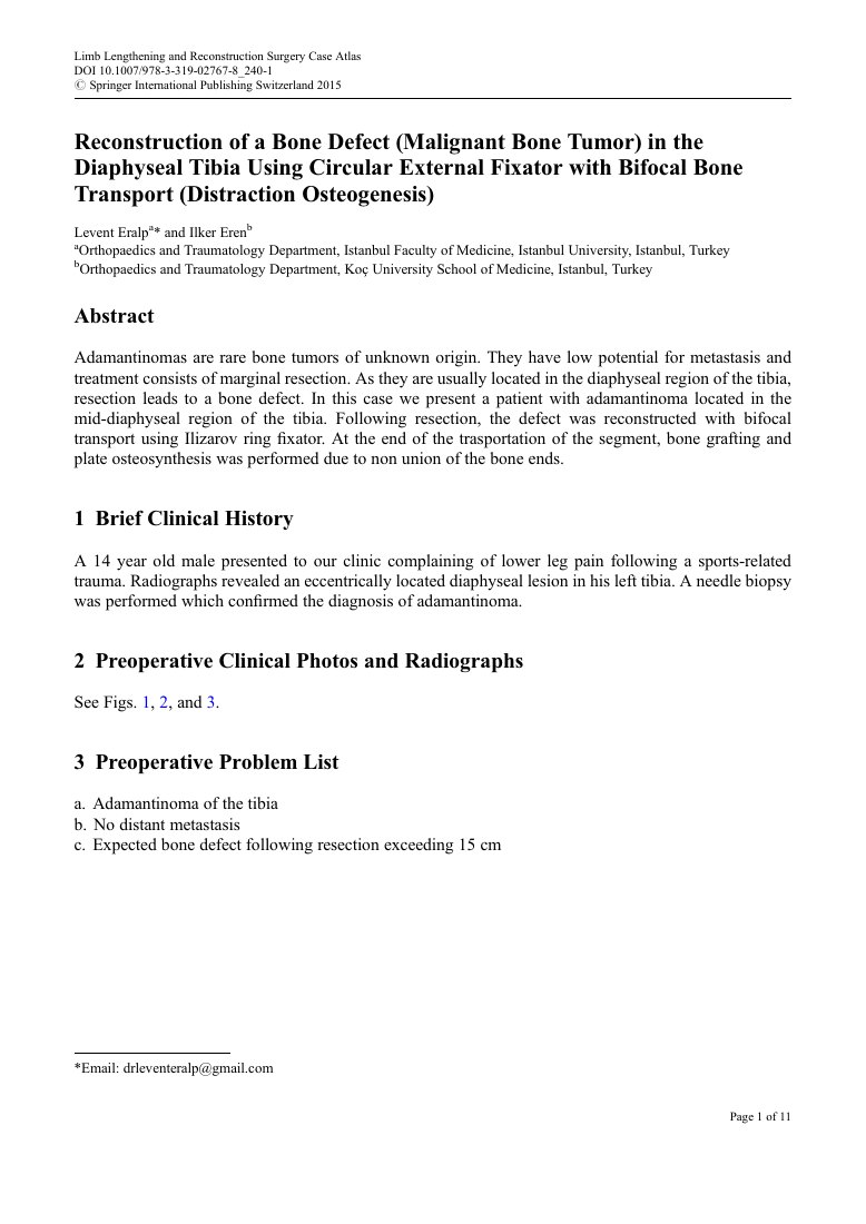 Reconstruction of a Diaphyseal Tibial Defect — ilk sayfa