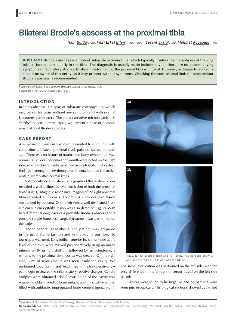 Bilateral Brodie's abscess at the proximal tibia — ilk sayfa