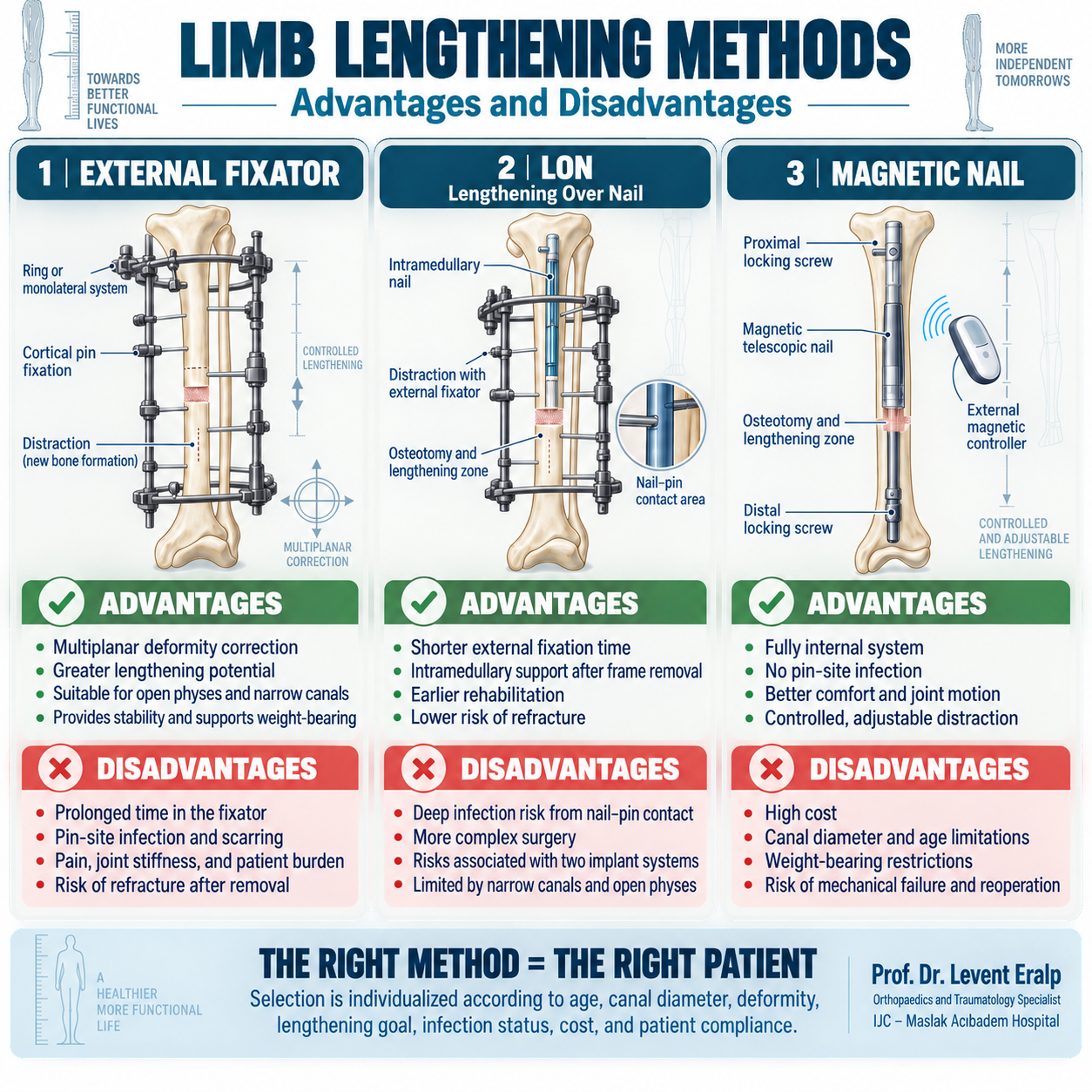 Limb Lengthening Methods