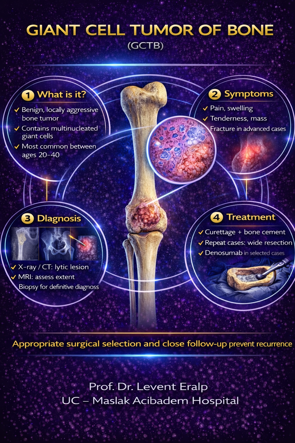 Giant Cell Tumor of Bone