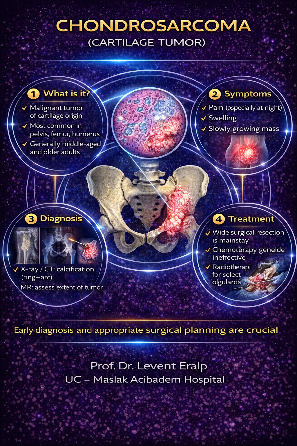 Chondrosarcoma