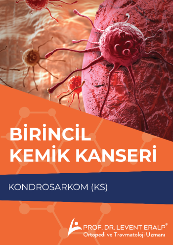 Birincil Kemik Kanseri  - KONDROSARKOM (KS) 