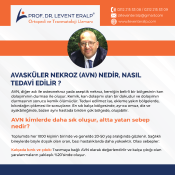 Avasküler Nekroz (AVN) Nedir, Nasıl Tedavi Edilir ?