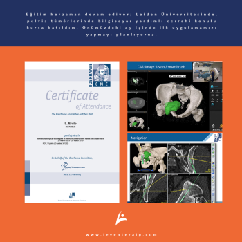 Eğitim herzaman devam ediyor; Leiden Üniversitesinde, pelvis tümörlerinde bilgisayar yardımlı cerrahi konulu kursa katıldım. Önümüzdeki ay içinde ilk uygulamamızı yapmayı planlıyoruz.